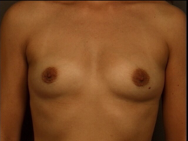 Before Image