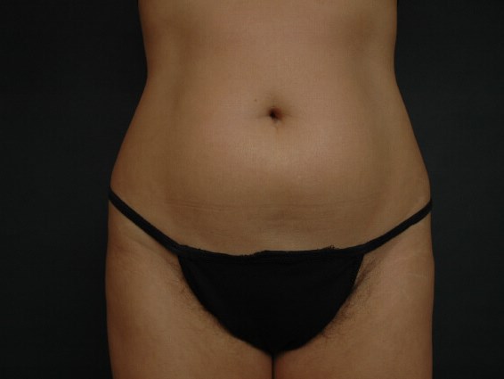 Before Image