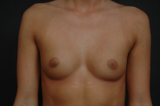 Before Image