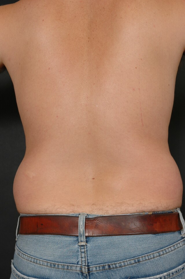 Before Image