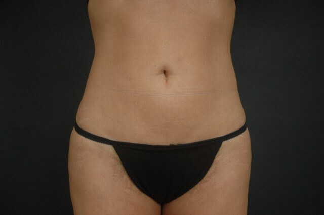After Image