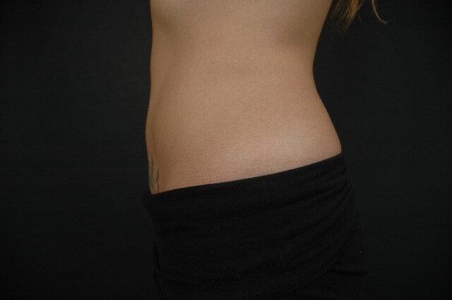 After Image